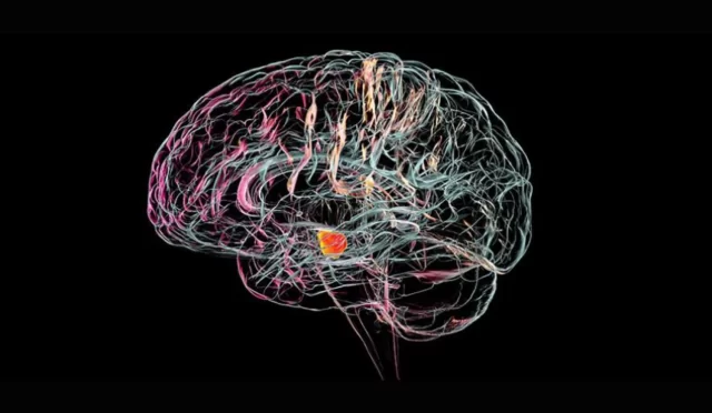 Parkinson’a Çare mi Geliyor? Bilim İnsanları Beyin İmplantı Üzerinde Çalışıyor!